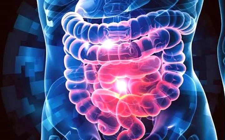 Casos de cáncer colorrectal en adultos y jovenes aumentan