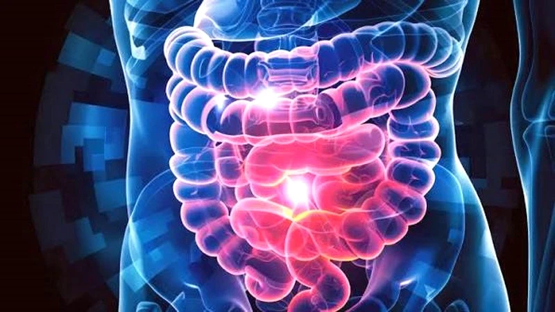 Casos de cáncer colorrectal en adultos y jovenes aumentan